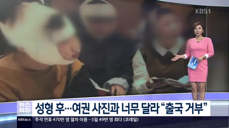 ▲ 10일 KBS '뉴스라인' 보도.