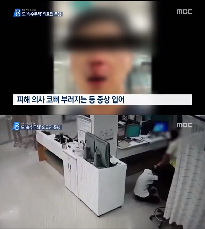 ▲ 지난 7월4일 MBC 뉴스데스크 보도. 머리채를 잡고 폭행하는 장면이 방송에 나왔다.